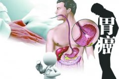 θ���������˵������ź�